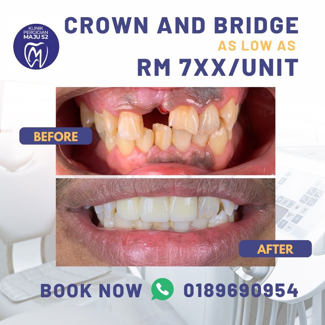 crown